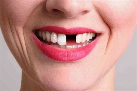 К чему выпадают зубы во сне без крови без боли