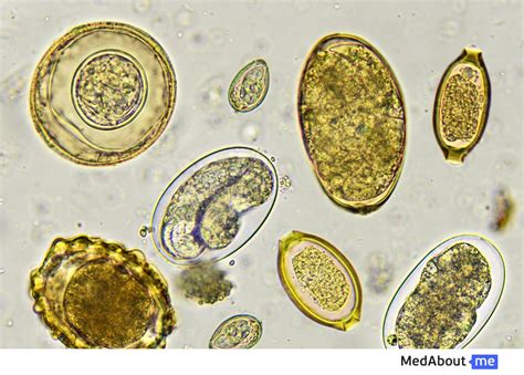Острицы в кале под микроскопом
