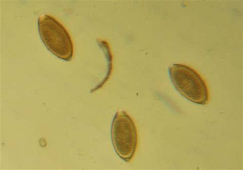 Острицы в кале под микроскопом