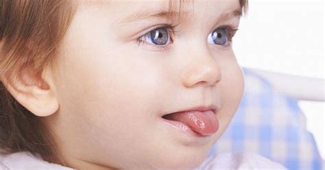 Подрезать уздечку языка ребенку
