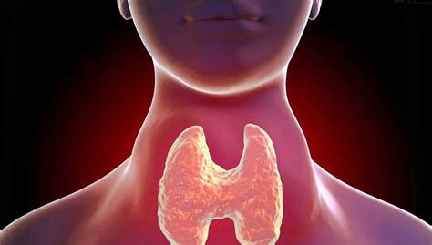 Тиреоидит щитовидной железы что