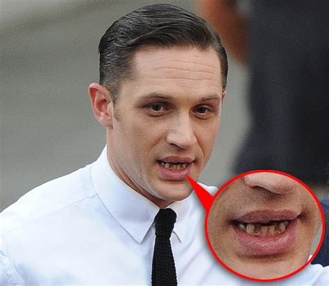 Том харди зубы