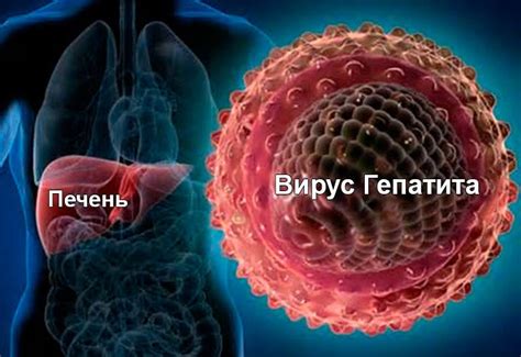 Что такое вирусный гепатит