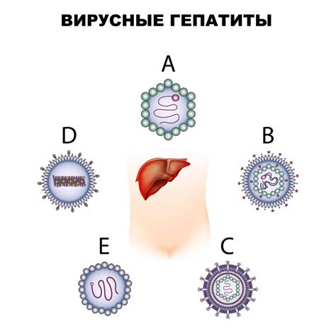 Что такое вирусный гепатит