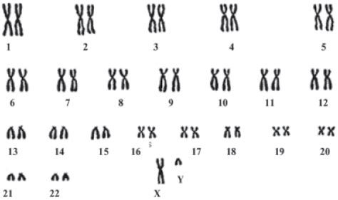 18 хромосома