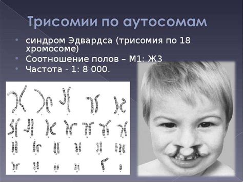 18 хромосома