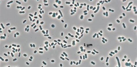 Acinetobacter lwoffii