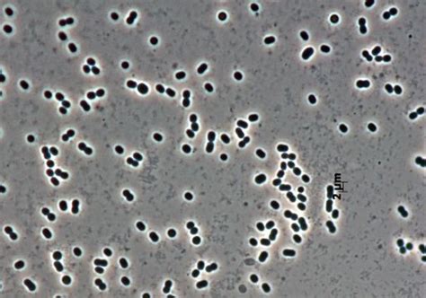 Acinetobacter lwoffii