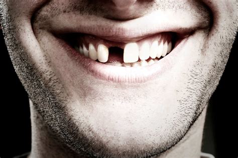 К чему выпадают зубы во сне без крови без боли